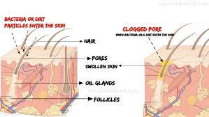 Warm compresses are known to moisturize wounds, cuts, and scabs from pimples and zits. 40 Best Ways To Get Rid Of Acne Scabs Overnight Diy Home Remedies