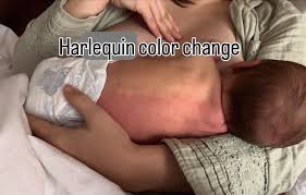 Image result for Harlequin Color Change