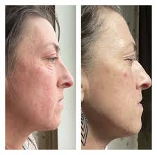 Botox 💉 + Bling 💎! Tucked away in one of my favorite small towns  (Monticello 🤍) are ✌🏾BOSS women that I got to hang out with today! 🤩 I  saw Jennifer Lieb