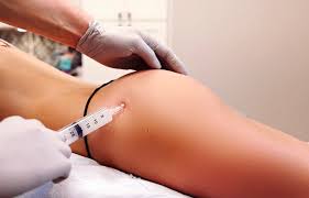 The sculptra buttocks cost will depend on several factors, such as how many treatments you need. Liquid Bbl In Atlanta Y Plastic Surgery