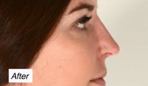 David W. Rodwell III, MD