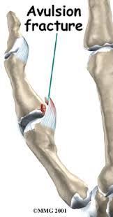 Pin On Knee Injury
