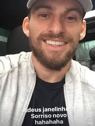 Lucas lima apareceu nas redes sociais para comemorar um ano de sua cirurgia de transplante capilar. Lucas Lima Fecha Janelinha E Entra Para O Time De Boleiros Que Deram Um Trato Nos Dentes Fotos R7 Futebol
