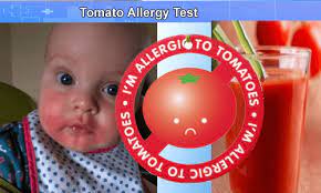 Tomato Allergies Causes Symptoms And Prevention