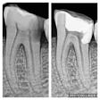 Dental X-ray / Tooth X-ray by Best Dentist in Dwarka Sec 7 product image