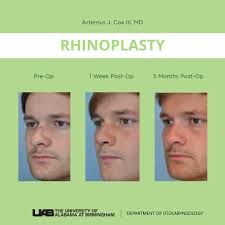 Artemus J. Cox III, MD (@uabfacialplasticsurgery) · Hoover, AL