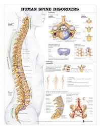 Human Spine Disorders Anatomical Chart Styrene Plastic