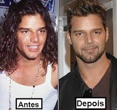 Resultado de imagem para antes e depois dos famosos