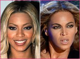 Beyonce Plastic Surgery Nose Job Plastic Surgery Before And After Plasticsurgery Beforeandafter Nos Beyonce Plastic Surgery Beyonce Nose Job Beyonce Nose