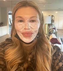 Brandi Glanville Recovering from Snow Peel to Treat Psoriasis Burns
