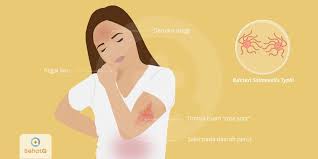 Yang disebut istilah tipus penyakit dalam adalah. Demam Tifoid Tipes Tanda Dan Gejala Penyebab Cara Mengobati Cara Mencegah