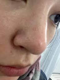 how can i help clear & minimize my sebaceous filaments? i use Pyunkang Yul  foaming cleanser & Thayers snow mushroom toner/moisturizer daily & Thayers  salicylic acid every other day. this is w a