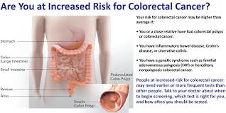 We'll use a cookie to save your choice. How Long Does Colon Cancer Take To Develop Develop Public Health