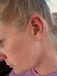 i've had my nose piercing for about three months now and about 1 week after  i had it done i go this weird spot