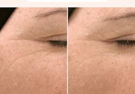 Squalane Vitamin C Rose Oil Biossance Sephora Rose Oil Squalane Squalane Oil