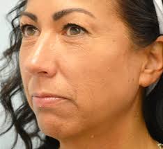 Arrowhead Plastic Surgery