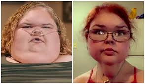 Estrela de reality show sobre obesidade mórbida impressiona com perda de  peso após bariátrica e prisão