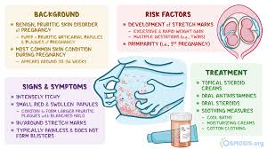 Image result for pruritic urticarial papules and plaques of pregnancy