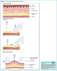 Image result for Subcutaneous Injection