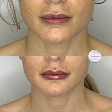 Deb Colbert, RN (@ageless_deb_) • Instagram photos and videos