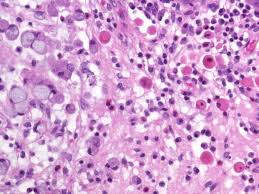 Free russell bodies photos and images. October 2014