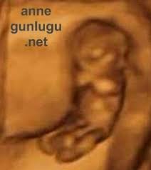 Ultrason kullanılarak bebeğin cinsiyeti belirlenebilirken, en erken olarak 13 hafta geçtiğinde, yani 3 ay bittikten sonra cinsiyet öğrenilebilir. Hamilelik 12 Hafta Gebelik 12 Hafta Onikinci Hafta Bebek Gelisimi Anne Gunlugu