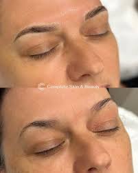 Complete Skin & Beauty Keperra