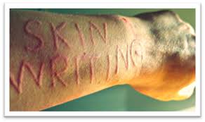 Image result for Dermatographism