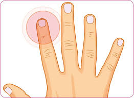 Zugsalbe Gegen Nagelbettentzundung Zugsalbe Effect