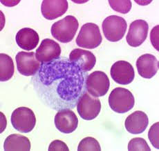 Search Hematologia Quizlet Hematology Medical Laboratory Medical Laboratory Science