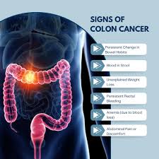 Image result for Blood in stool