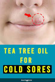 Pin On Essential Oils