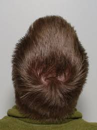 Stylists need to keep in mind that the hair should have the right length for the hair to grow in the direction that one desires. Double Crown Hair