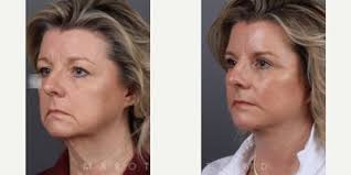 James C. Marotta, MD, Board Certified Facial Plastic Surgeon