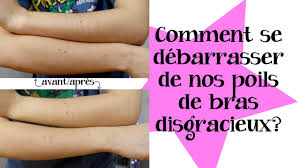 Quant aux poils du nez et des oreilles, ils filtrent le son, les odeurs et certaines poussières. Comment Se Debarrasser Des Poils De Bras Youtube