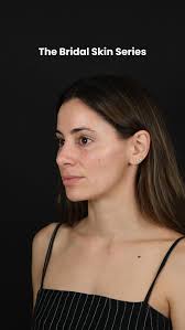 Another bridal glow up journey with one of my beautiful patients. She came  to me about two months before her wedding looking to improve her skin  texture, pigment, and pore size. These treatments ...