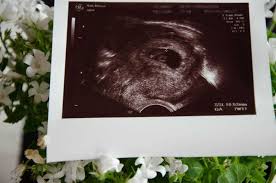 Von Der 8 Und 9 Ssw Tipps Fur Eltern Baby Kind Und Meer
