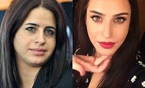 Süreyya yalçın hollywood gülüşü için servet harcadı! Busra Pekin In Inanilmaz Degisim Iste Busra Pekin Kilolu Ve Simdiki Hali Foto Galerisi 1 Resim