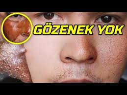 Ilk Yaptiginizda Sok Olacaksiniz Sur Soy Gozenek Yok Edici Yuz Cilt Maskesi Guzellik Bakim Youtube Organik Cilt Bakimi Cilt Urunleri Cilt Ipuclari
