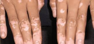 أن أرى حجم تلك الأزبار ادخلت يدي من طرفي كيلوتاتهم لأمسك بحنشين كبار لهست من ضخامتهم رفع المدير مؤخرته قليلا لخلع كيلوته وااااو لم يكن زب انسان بل وأجزم أنه بحجم زب. Ø£Ø³Ø¨Ø§Ø¨ Ø§Ù„Ø¨Ø±Øµ Ø­ÙŠØ§ØªÙƒ