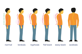 Image result for Posture