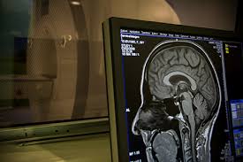 Centre d'imagerie médicale, etablissement conventionné. A Poitiers Radiologues Du Chu Et De Ville Partagent Scanner Et Irm Depuis 3 Ans