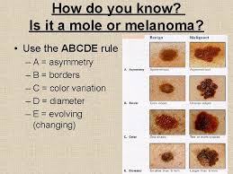 Por lo tanto, es importante saber dónde aparecen los lunares y su apariencia. Skin Cancer Introduction All Life On Earth Depends