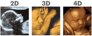 These before and after images are from actual 3d/4d ultrasound sessions performed at pregnantsee! 3d Ultrasound Atlanta 4d Ultrasound Hd Ultrasound Atlanta Ga