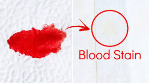 Remove Old And Dried Blood Stains From Clothes Mattress Blanket Bed Or Any Kind Of Fabric Youtube