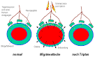 Serotonin gegen migrane