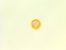 Image result for Melastomastrum