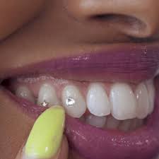 Why Celebrities Love Tooth Gems Video Tooth Gem Teeth Jewelry Diamond Teeth