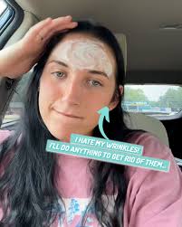 I'm in my 20’s and I hate my wrinkles