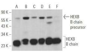 Hexb B Chain Antibody D 9 Scbt Santa Cruz Biotechnology